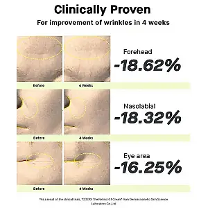 Cosrx The Retinol 0.1 Cream Κρέμα Προσώπου Λαιμού και Ματιών με Ρετινόλη Αντιρυτιδική & Για Δέρμα με Ακμή 20ml