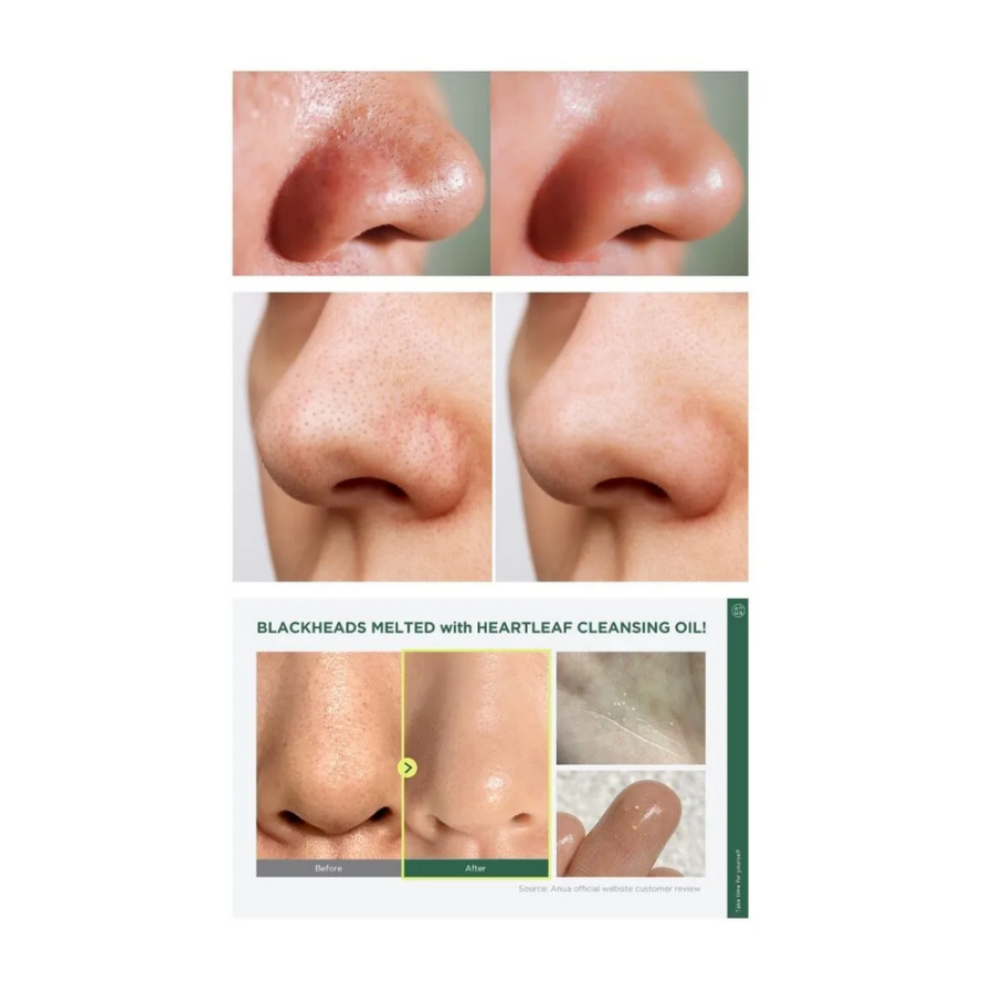 Anua Heartleaf Pore Control Cleansing  – Έλαιο για βαθύ καθαρισμό των πόρων - 200ml