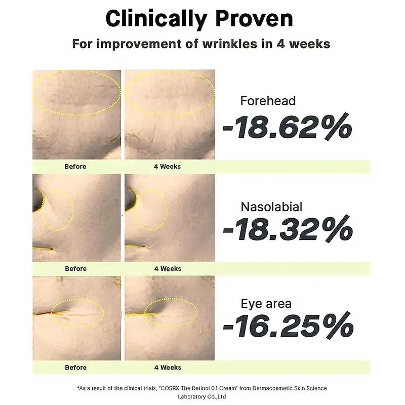 Cosrx The Retinol 0.1 Cream Κρέμα Προσώπου Λαιμού και Ματιών με Ρετινόλη Αντιρυτιδική & Για Δέρμα με Ακμή 20ml