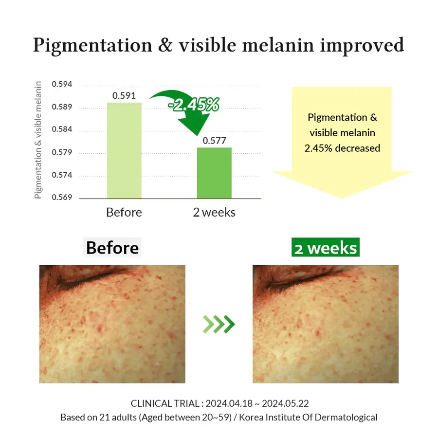 Dr. Althea Gentle Vitamin C Serum - 30 ml